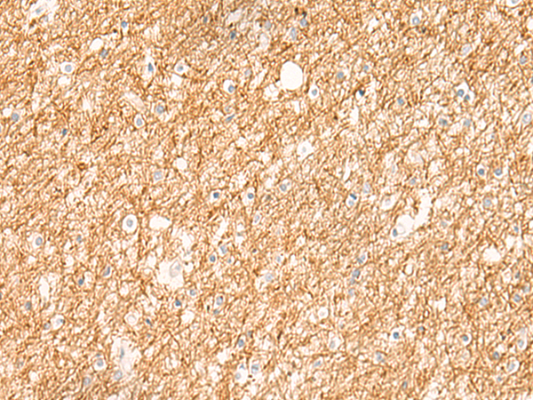 Rabbit Polyclonal Antibody to ZNF185