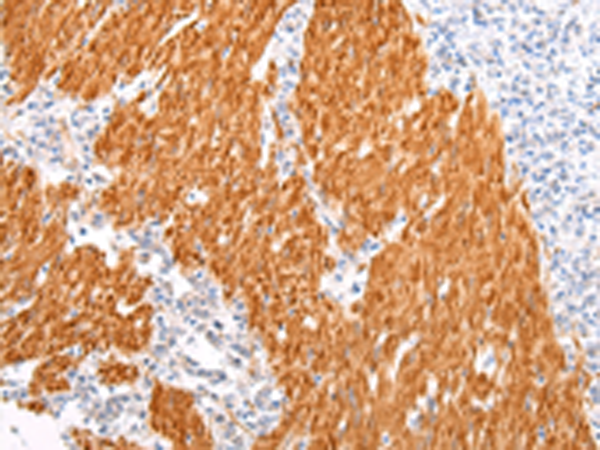 Rabbit Polyclonal Antibody to BSN