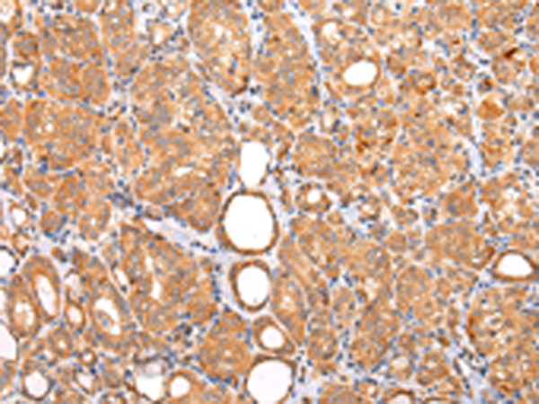 Rabbit Polyclonal Antibody to ZNF420