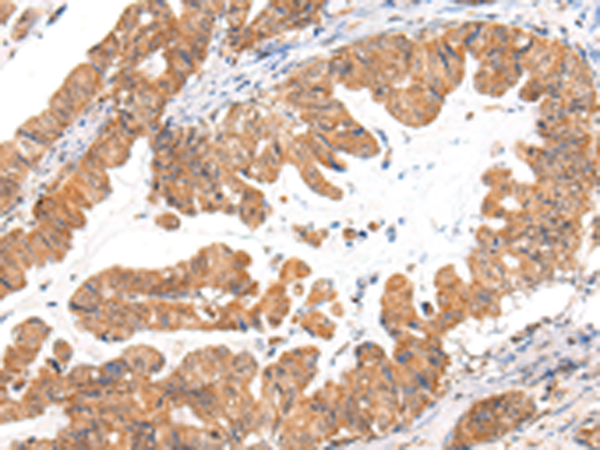 Rabbit Polyclonal Antibody to CASZ1