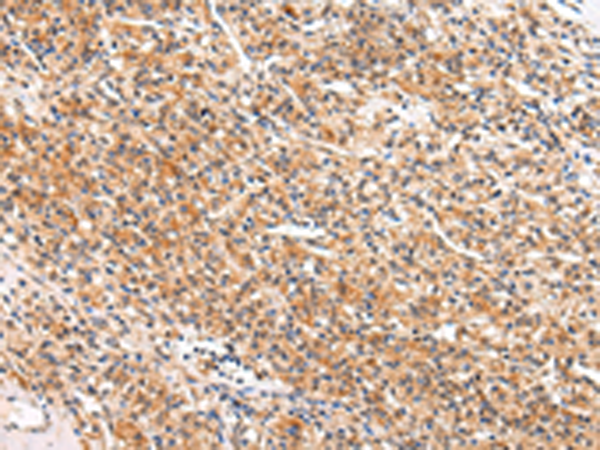 Rabbit Polyclonal Antibody to APLN