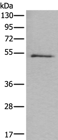 Rabbit Polyclonal Antibody to KRT7