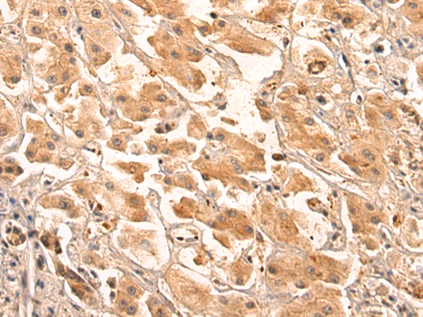 Rabbit Polyclonal Antibody to COL8A2