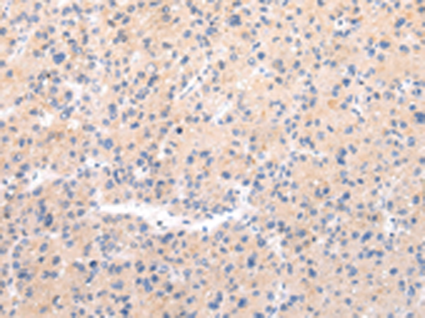 Rabbit Polyclonal Antibody to MUC7