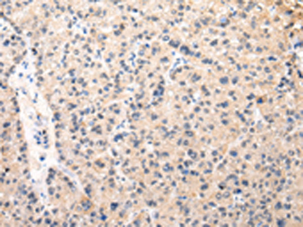 Rabbit Polyclonal Antibody to MUC1(NT)
