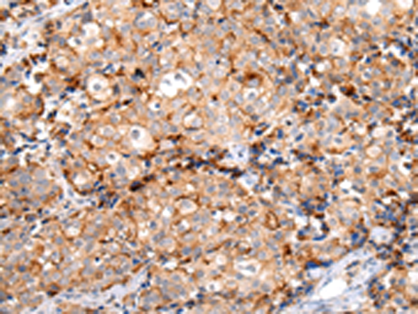 Rabbit Polyclonal Antibody to MUC1(CT)