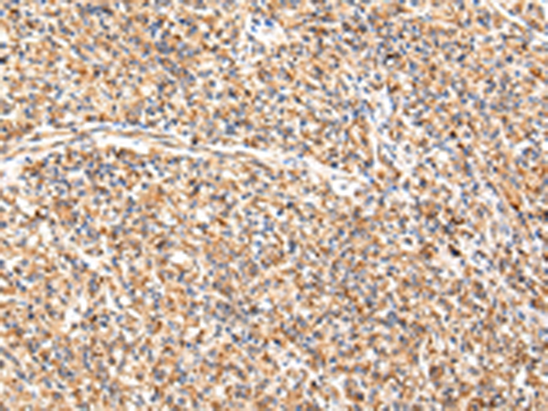Rabbit Polyclonal Antibody to ADAMTS1