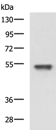 Rabbit Polyclonal Antibody to CLU