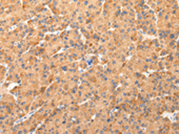 Rabbit Polyclonal Antibody to AQP7