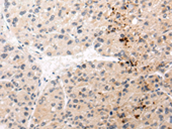 Rabbit Polyclonal Antibody to AQP11