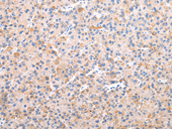 Rabbit Polyclonal Antibody to AXIN1