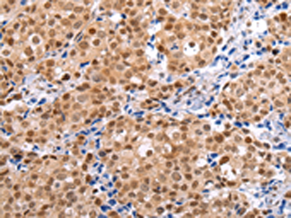 Rabbit Polyclonal Antibody to BRMS1