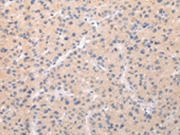 Rabbit Polyclonal Antibody to ABCC1