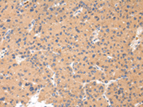 Rabbit Polyclonal Antibody to CTSK