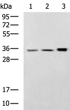 Rabbit Polyclonal Antibody to CTSS