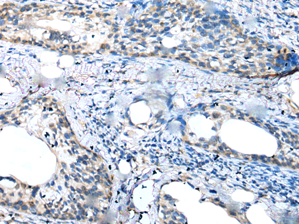 Rabbit Polyclonal Antibody to CCL14