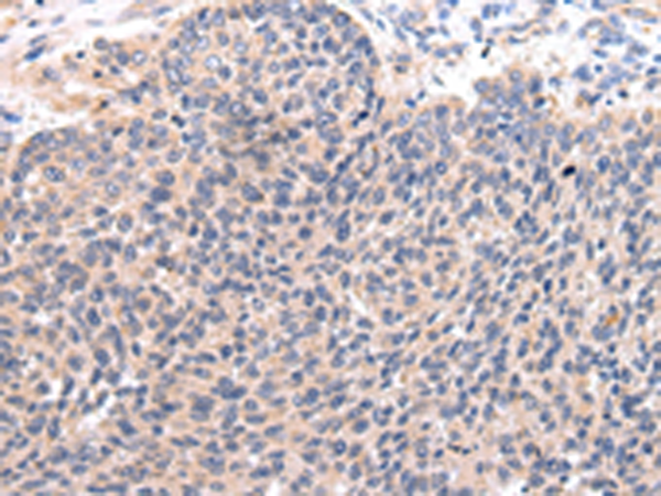 Rabbit Polyclonal Antibody to CCL7