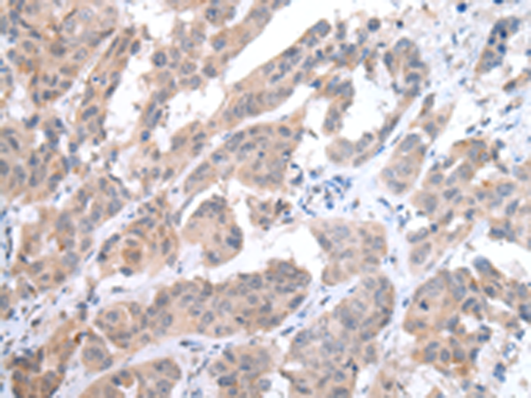 Rabbit Polyclonal Antibody to CCR6