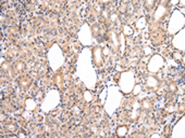 Rabbit Polyclonal Antibody to CDK8
