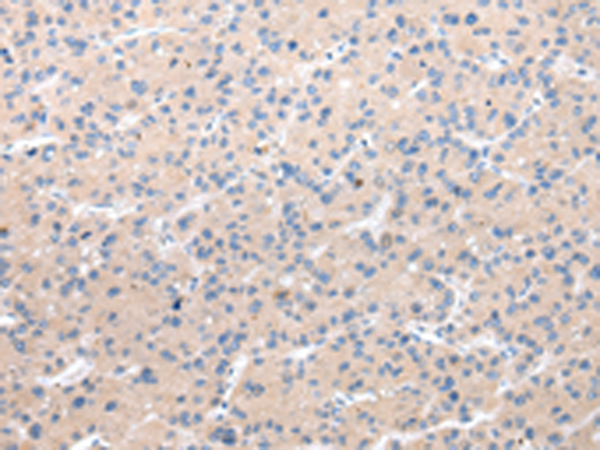 Rabbit Polyclonal Antibody to CHRM5