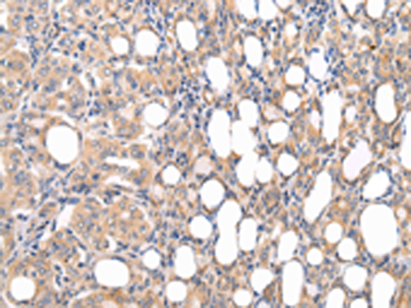 Rabbit Polyclonal Antibody to CMKLR1