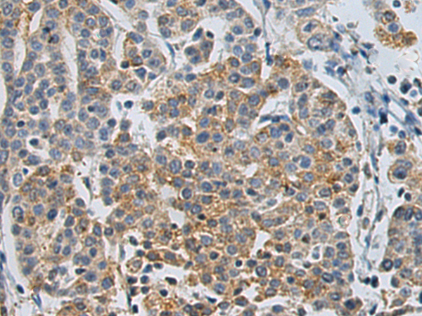 Rabbit Polyclonal Antibody to CLEC14A