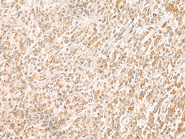 Rabbit Polyclonal Antibody to MYCT1