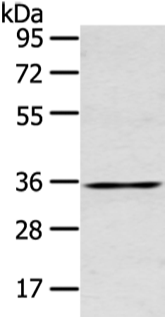 Rabbit Polyclonal Antibody to GJB5