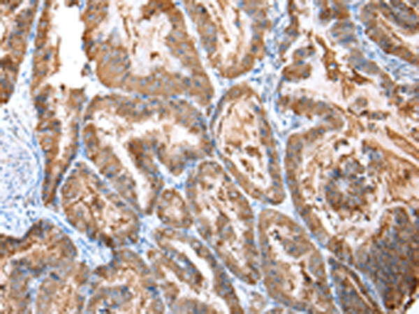 Rabbit Polyclonal Antibody to CXCR4
