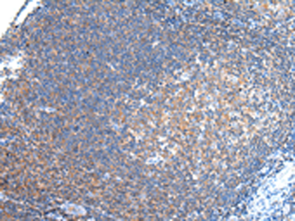 Rabbit Polyclonal Antibody to PCDHA6