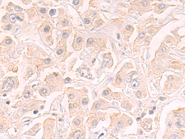 Rabbit Polyclonal Antibody to COLEC12