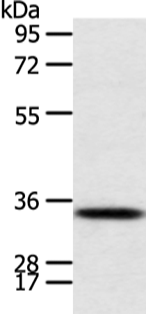 Rabbit Polyclonal Antibody to CALB2