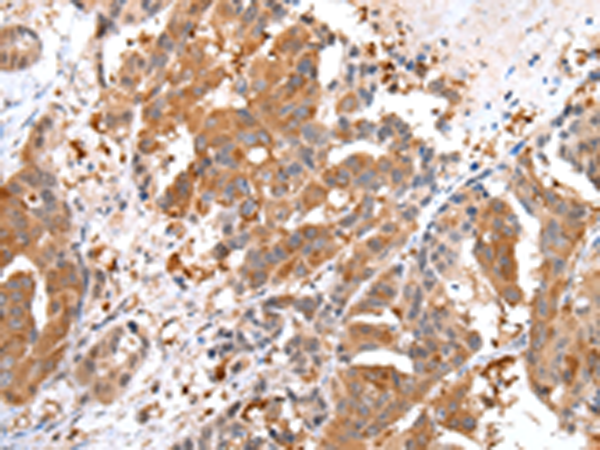 Rabbit Polyclonal Antibody to FASN