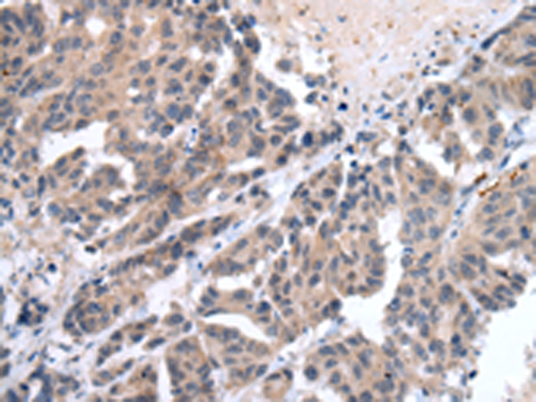 Rabbit Polyclonal Antibody to VEGFD