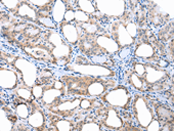 Rabbit Polyclonal Antibody to APH1A