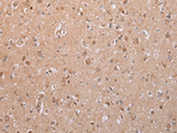 Rabbit Polyclonal Antibody to TLR5