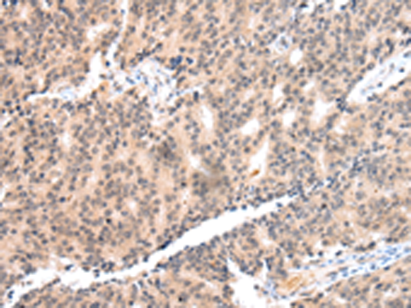 Rabbit Polyclonal Antibody to COX17