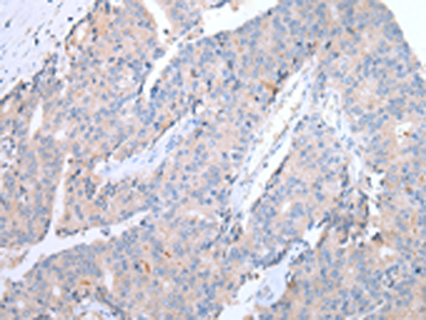 Rabbit Polyclonal Antibody to CCR10