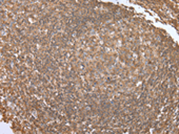 Rabbit Polyclonal Antibody to ADRB2
