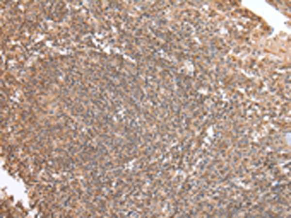 Rabbit Polyclonal Antibody to DVL1