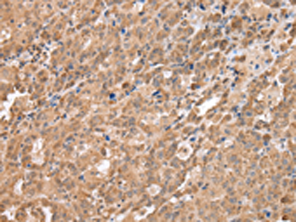 Rabbit Polyclonal Antibody to DDX58