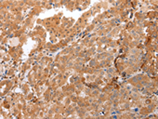 Rabbit Polyclonal Antibody to DEFB4A