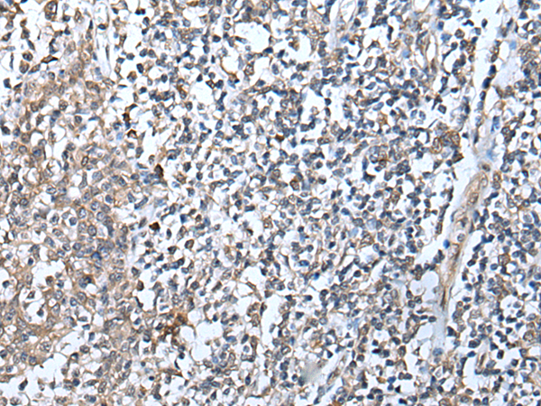 Rabbit Polyclonal Antibody to DEFB104A