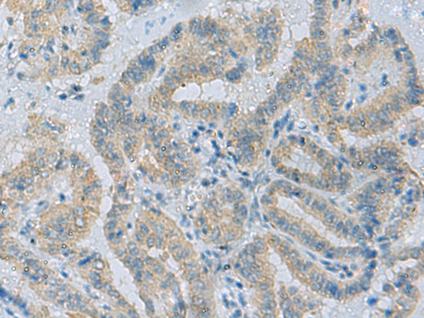 Rabbit Polyclonal Antibody to DEFB1