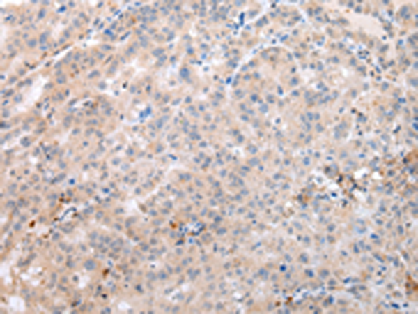 Rabbit Polyclonal Antibody to DEFB112