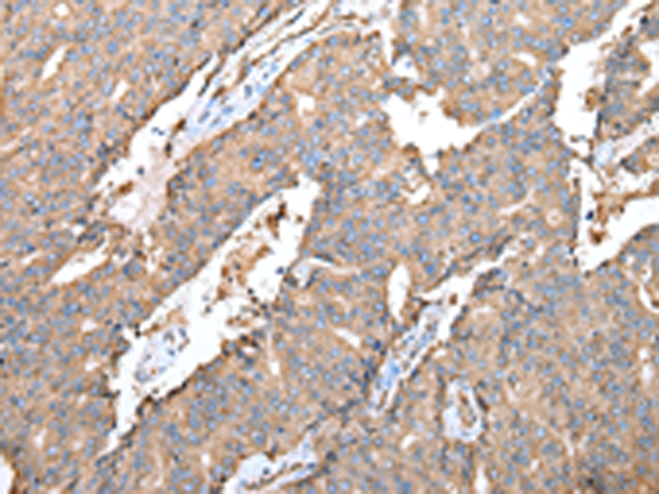 Rabbit Polyclonal Antibody to SPINK7