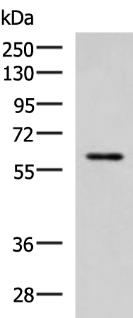 Rabbit Polyclonal Antibody to ECM1