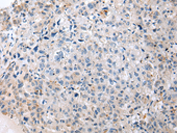 Rabbit Polyclonal Antibody to ENPP1