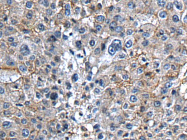 Rabbit Polyclonal Antibody to PTGER3