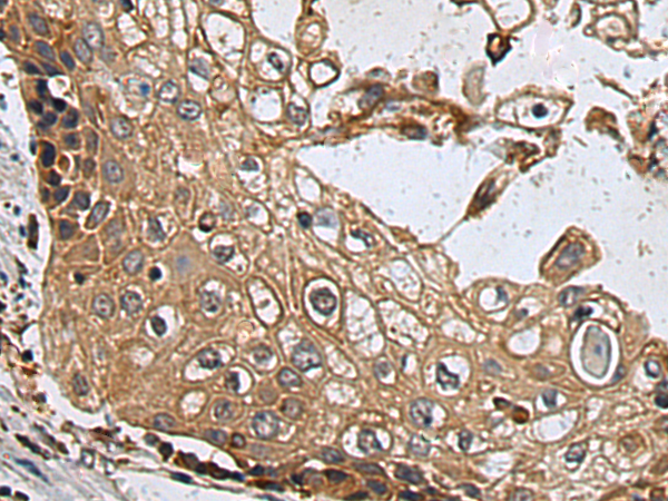 Rabbit Polyclonal Antibody to EPHA2